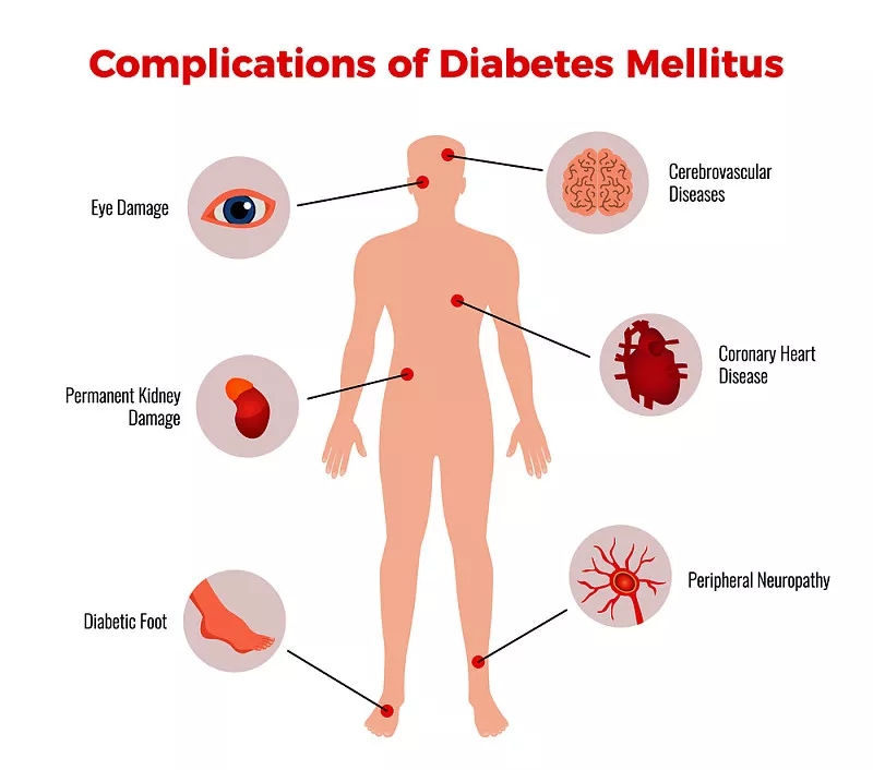 間充質干細胞在治療糖尿病及并發癥的臨床應用潛力