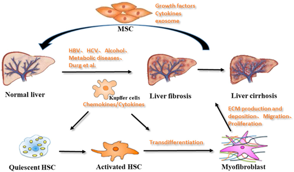 肝纖維化的形成機(jī)制