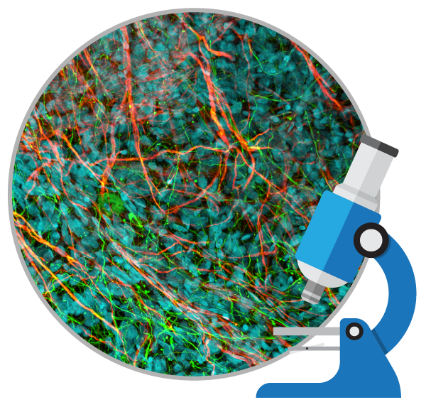 干細(xì)胞治療如何對(duì)自閉癥患者提供幫助？