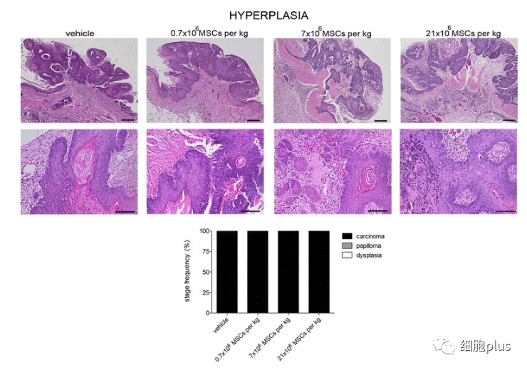 2?全身施用同種異體間充質(zhì)干細胞不會增加腫瘤惡性程度