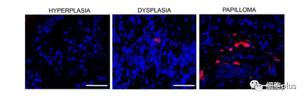 4?全身注射同種異體間充質(zhì)干細胞很少進入癌前病變