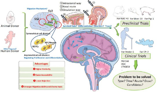 神經干細胞移植治療中風的臨床試驗的步驟和挑戰 神經干細胞移植治療中風的臨床試驗的步驟和挑戰