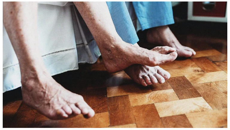 什么是類風濕關節炎？癥狀，治療，原因以及你需要知道的一切