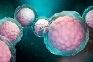 干細胞治療糖尿病