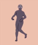 運(yùn)動障礙型腦癱涉及過度的不自主運(yùn)動。
運(yùn)動障礙性腦癱的類型
肌張力障礙：僵硬和松弛交替出現(xiàn)，
舞蹈徐徐樣腦癱：持續(xù)的不自主運(yùn)動導(dǎo)致姿勢異常。