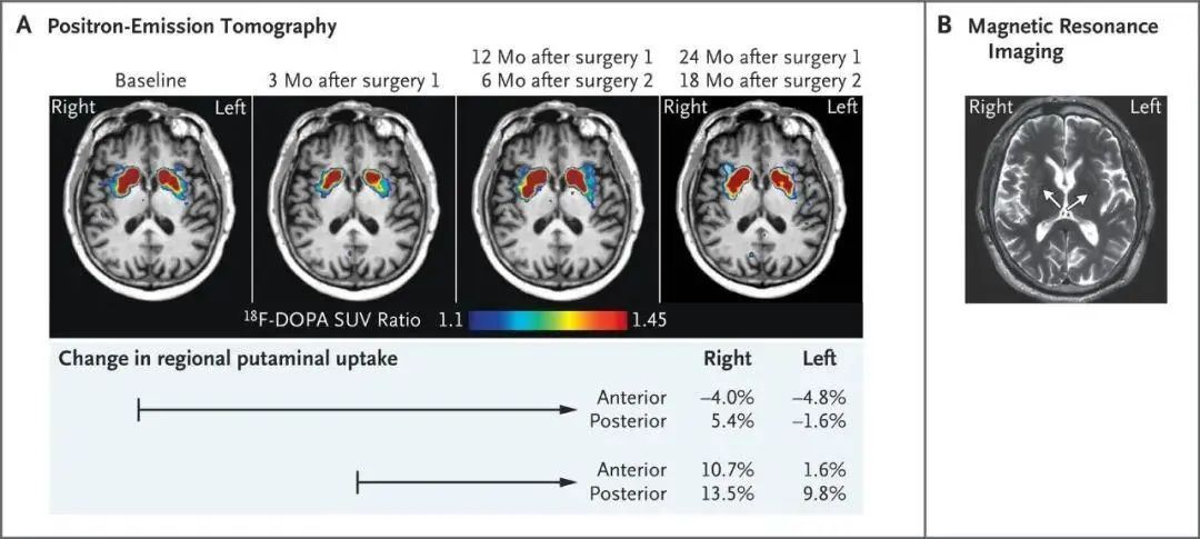 -?斷層掃描圖像?-