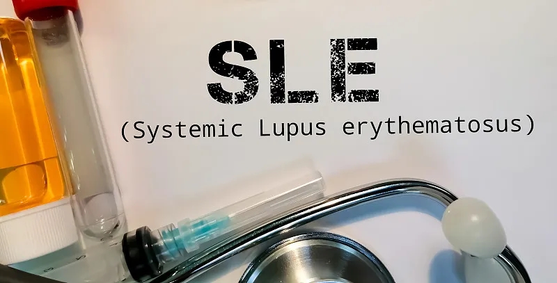 南京鼓樓醫院：干細胞治療在系統性紅斑狼瘡中維持長期治療效果