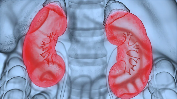 什么是腎病綜合征?癥狀和治療 什么是腎病綜合征?癥狀和治療