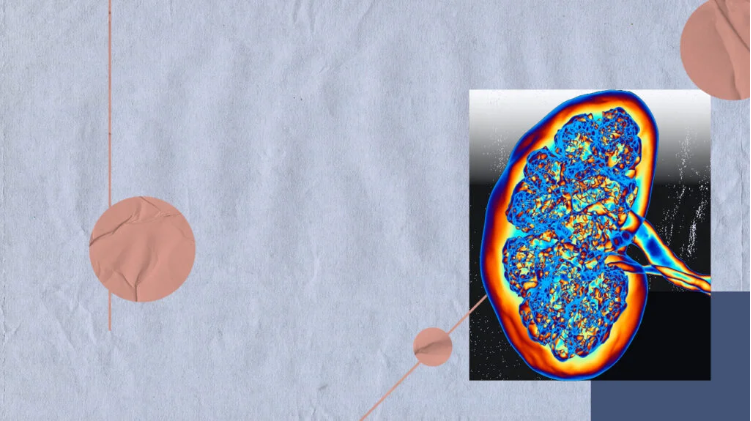 急性腎損傷與腎衰竭：它們有何不同？