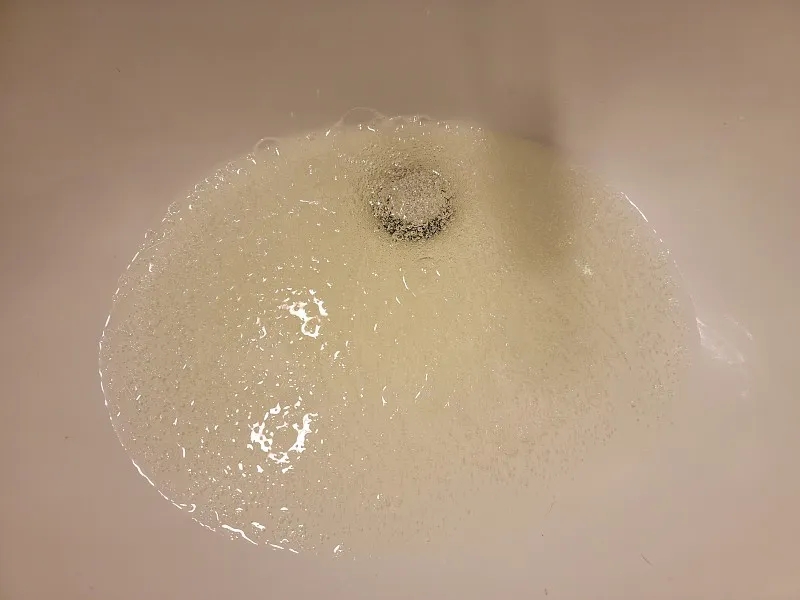 免疫球蛋白和免疫球蛋白血液化驗(yàn):功能和目的 免疫球蛋白和免疫球蛋白血液化驗(yàn):功能和目的