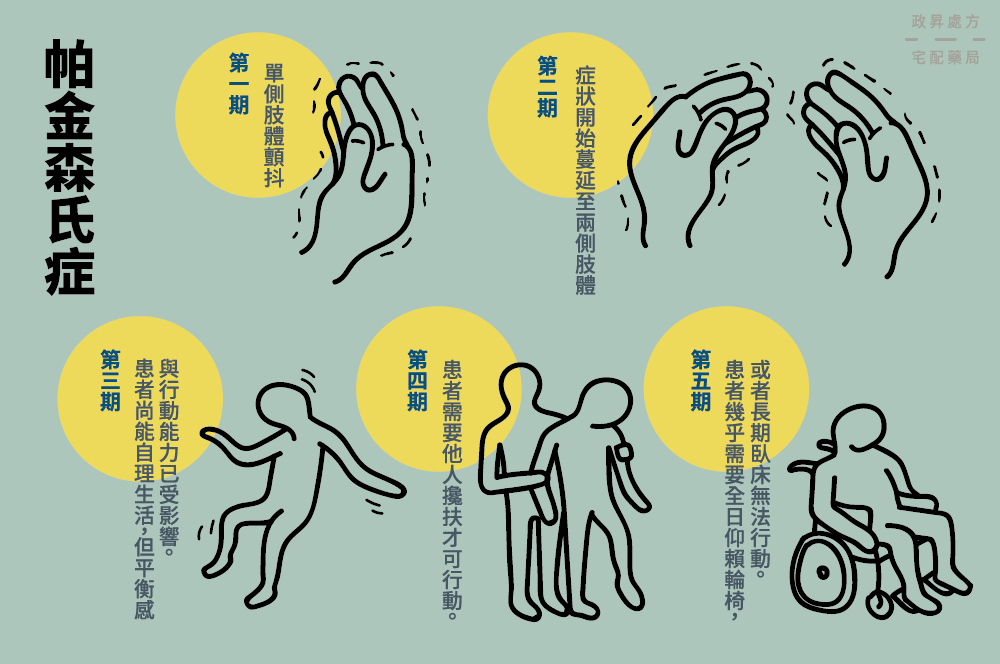 神經干細胞移植管理帕金森病：挑戰、納米技術支持和前景