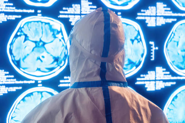 間充質干細胞三大作用機制用于治療中樞神經系統疾病