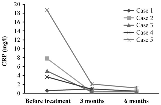 圖4：每位患者治療前后的CRP水平。1名患者的CRP水平降低，而其他4名患者的CRP水平保持穩定并在正常范圍內。