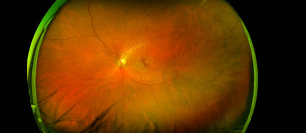 北大人民醫院眼科研究所：干細胞治療遺傳性視網膜疾病研究看點