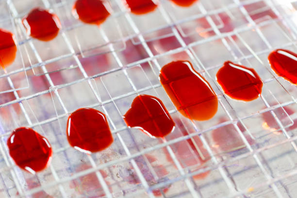 可以用臍帶血干細胞可以治療哪些疾?。? class=