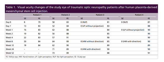 2021年干細胞治療神經病變臨床案例