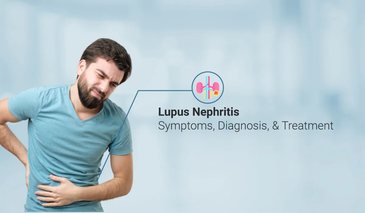 狼瘡性腎炎癥狀與發病原因