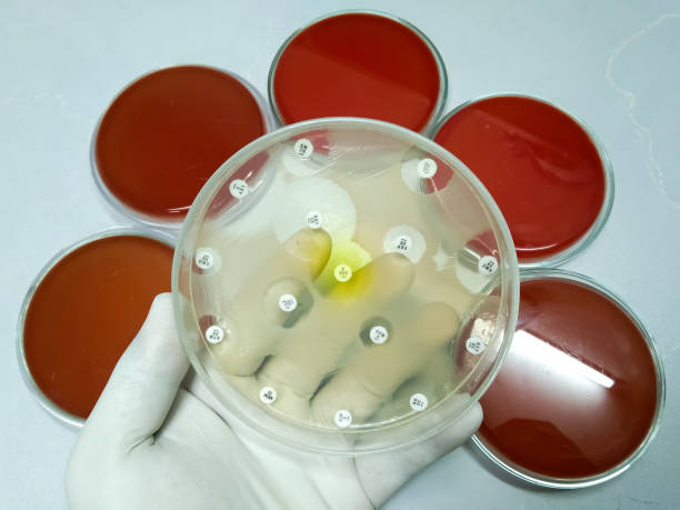 骨髓移植成功率100％嗎？