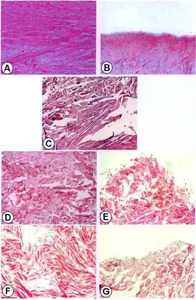 不同時間點修復組織紅-紅區與白-白區II型膠原表達量
