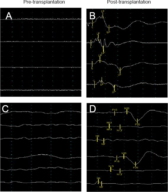 神經電生理學改善
