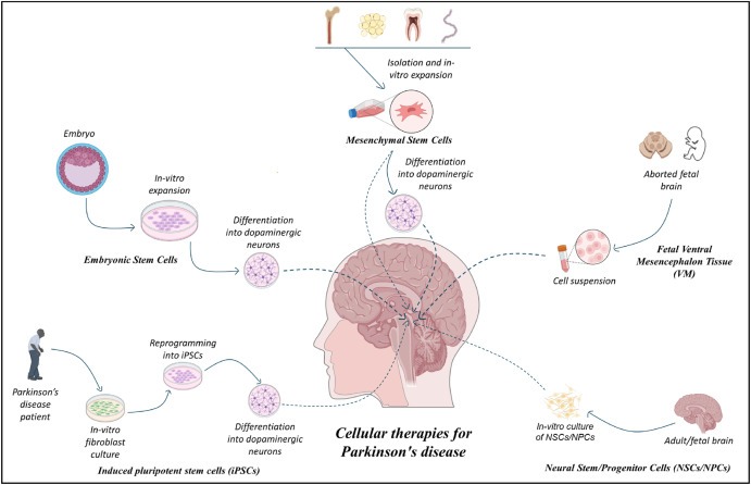 圖1：帕金森病的細胞療法：胚胎干細胞 (ESC)、誘導性多能干細胞 (iPSC)、間充質干細胞 (MSC)、神經干細胞/祖細胞 (NSC/NPS) 是帕金森病的新興候選藥物。
