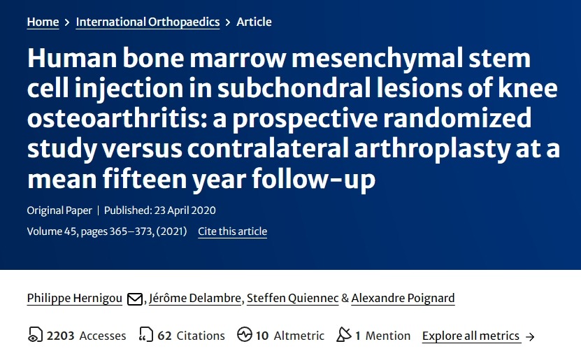 人類骨髓間充質干細胞注射治療膝骨關節炎軟骨下損傷：一項前瞻性隨機研究，對比平均15年隨訪的對側關節置換術