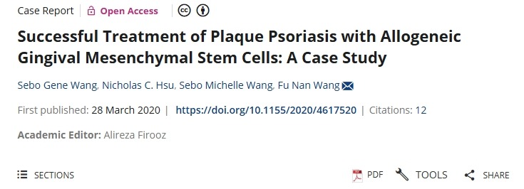 用同種異體牙齦間充質干細胞成功治療斑塊狀銀屑?。喊咐芯? class=