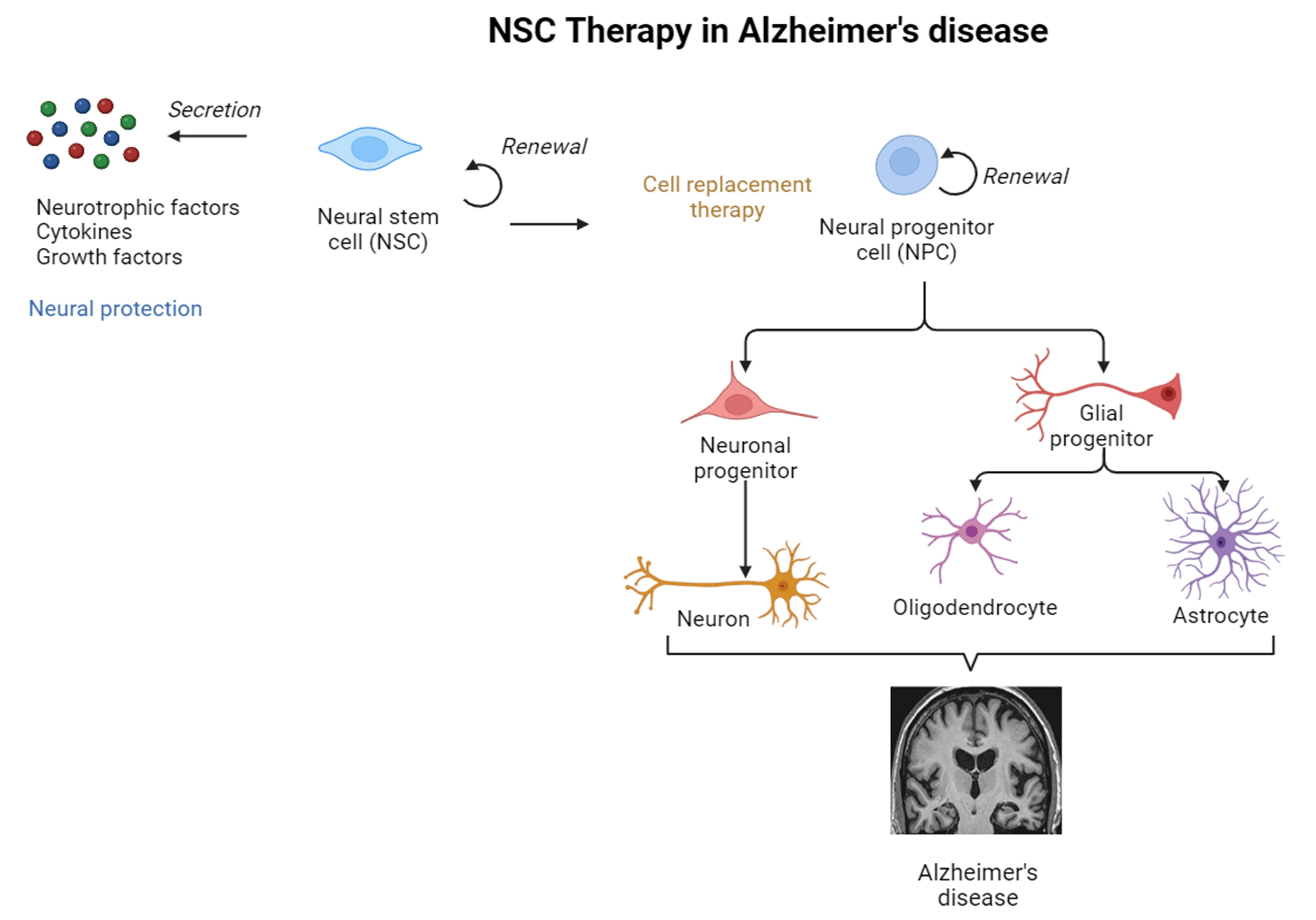 神經干細胞移植治療阿爾茨海默病的圖解摘要