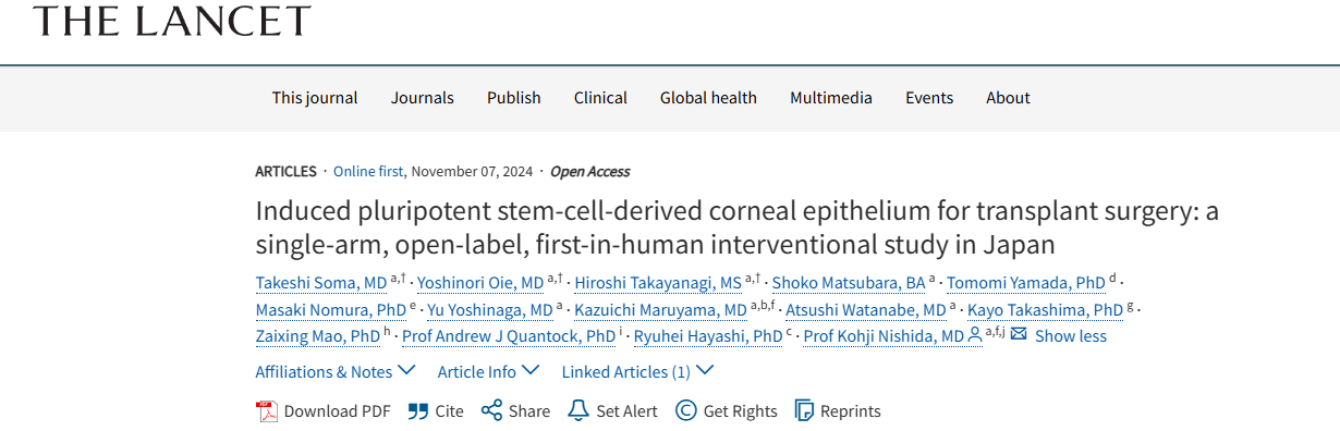 《誘導性多能干細胞來源的角膜上皮用于移植手術：日本的一項單臂、開放標簽、首次人體介入研究》