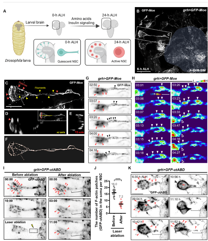 圖2:靜息態(tài)神經(jīng)干細(xì)胞再激活過(guò)程中的F-肌動(dòng)蛋白結(jié)構(gòu)和動(dòng)力學(xué) 圖2:靜息態(tài)神經(jīng)干細(xì)胞再激活過(guò)程中的F-肌動(dòng)蛋白結(jié)構(gòu)和動(dòng)力學(xué)
