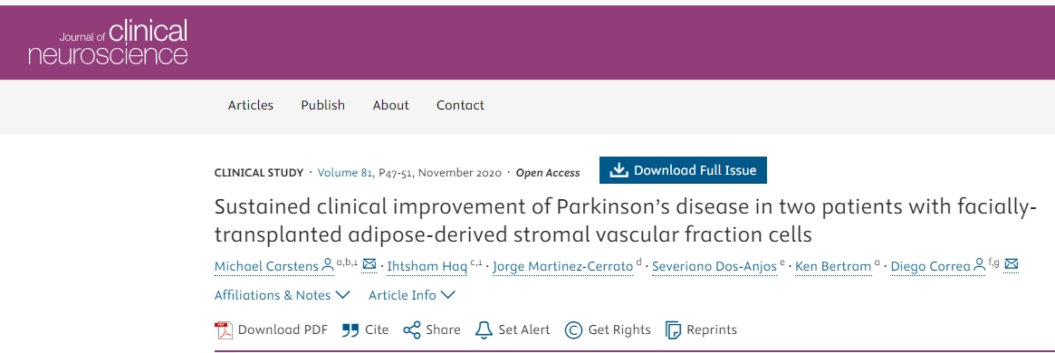 面部移植間充質干細胞治療2例帕金森病患者，患者臨床癥狀持續改善