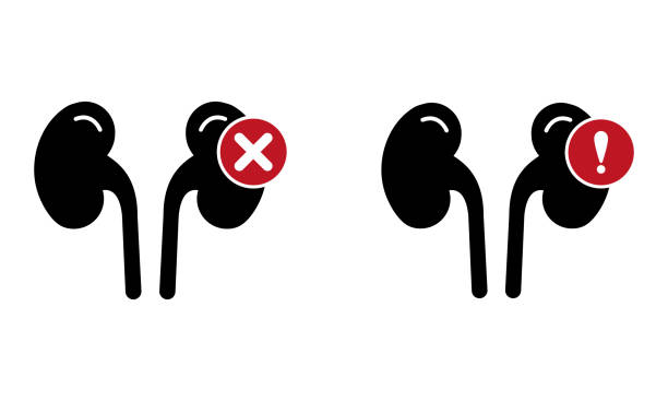 探索干細胞療法：能否成為降低腎病患者肌酐水平的新希望？