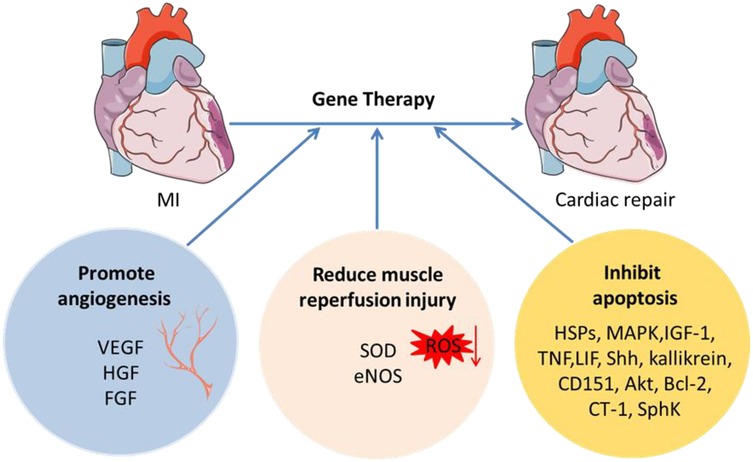 圖2：MI基因治療示意圖。