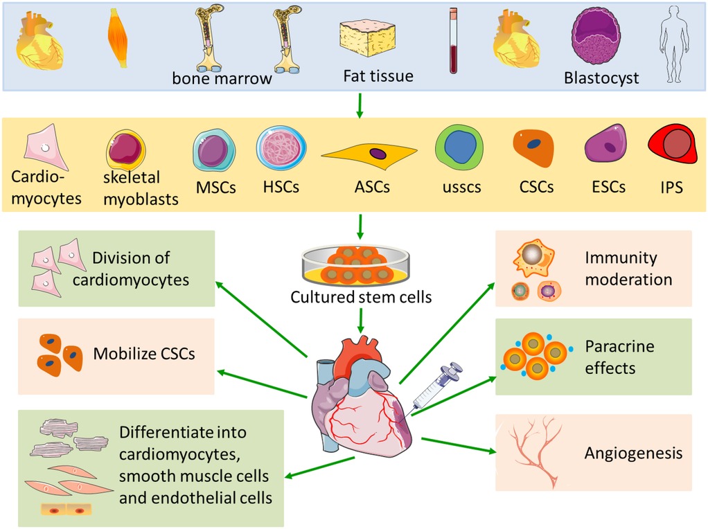 圖1：心肌梗死中的干細胞療法示意圖。