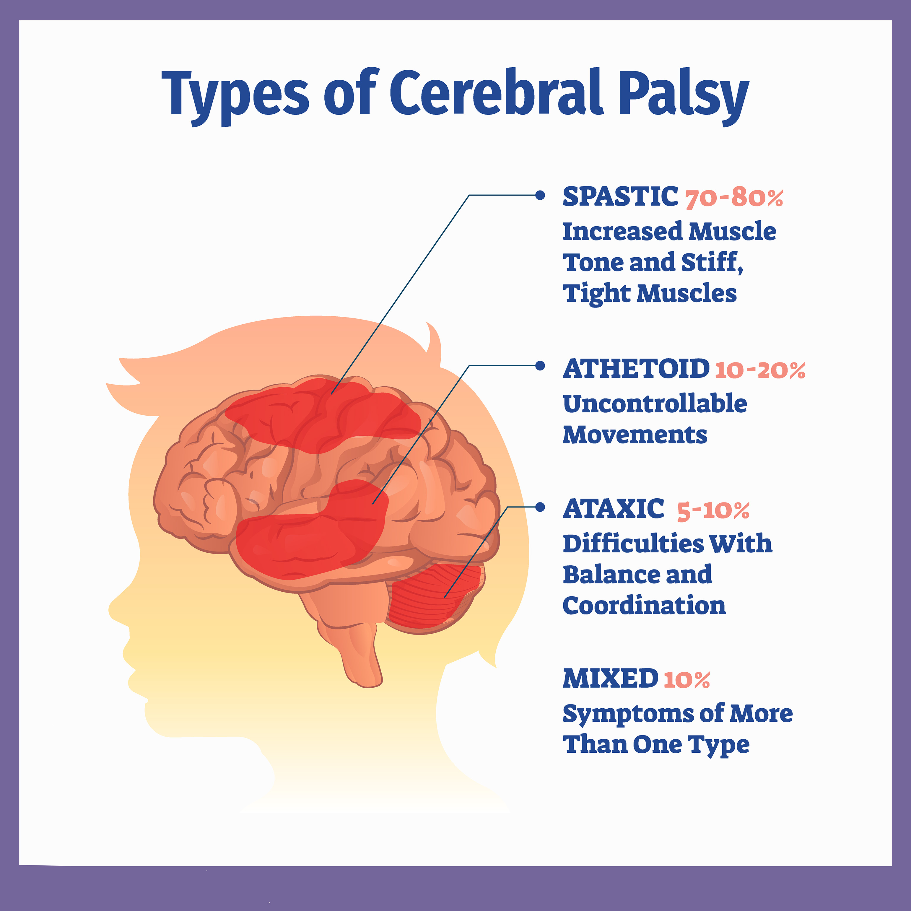 低劑量VS高劑量：不同劑量的干細胞治療腦癱哪個更加安全？