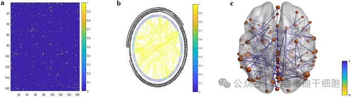圖5:(a) 加權(quán)鄰接矩陣和 (b) 循環(huán)網(wǎng)絡(luò)顯示多發(fā)性硬化癥組在治療6個(gè)月后的連接增加。 