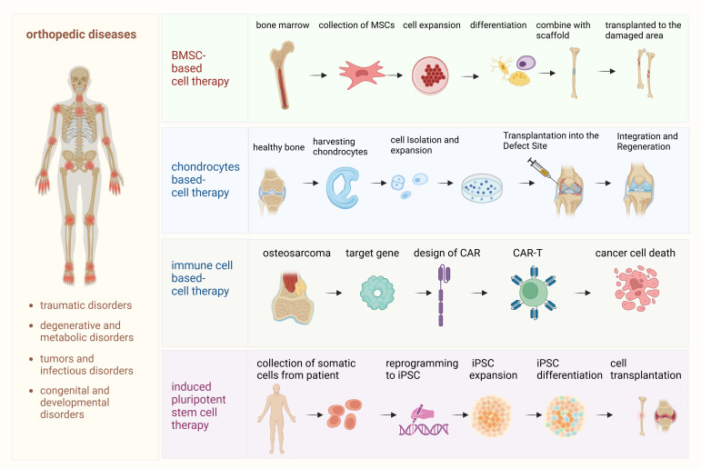 圖1：骨科疾病細胞療法的詳細流程。該圖概述了用于治療骨科疾病的各種細胞療法所涉及的逐步流程。
