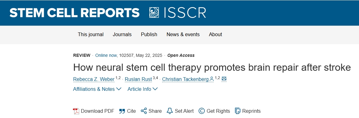 神經干細胞療法如何促進中風后的大腦修復