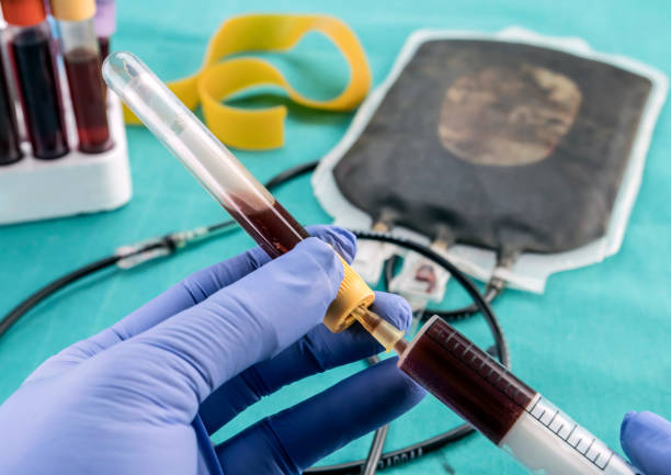 自體干細胞移植費用及副作用：三大客觀視角下的真相