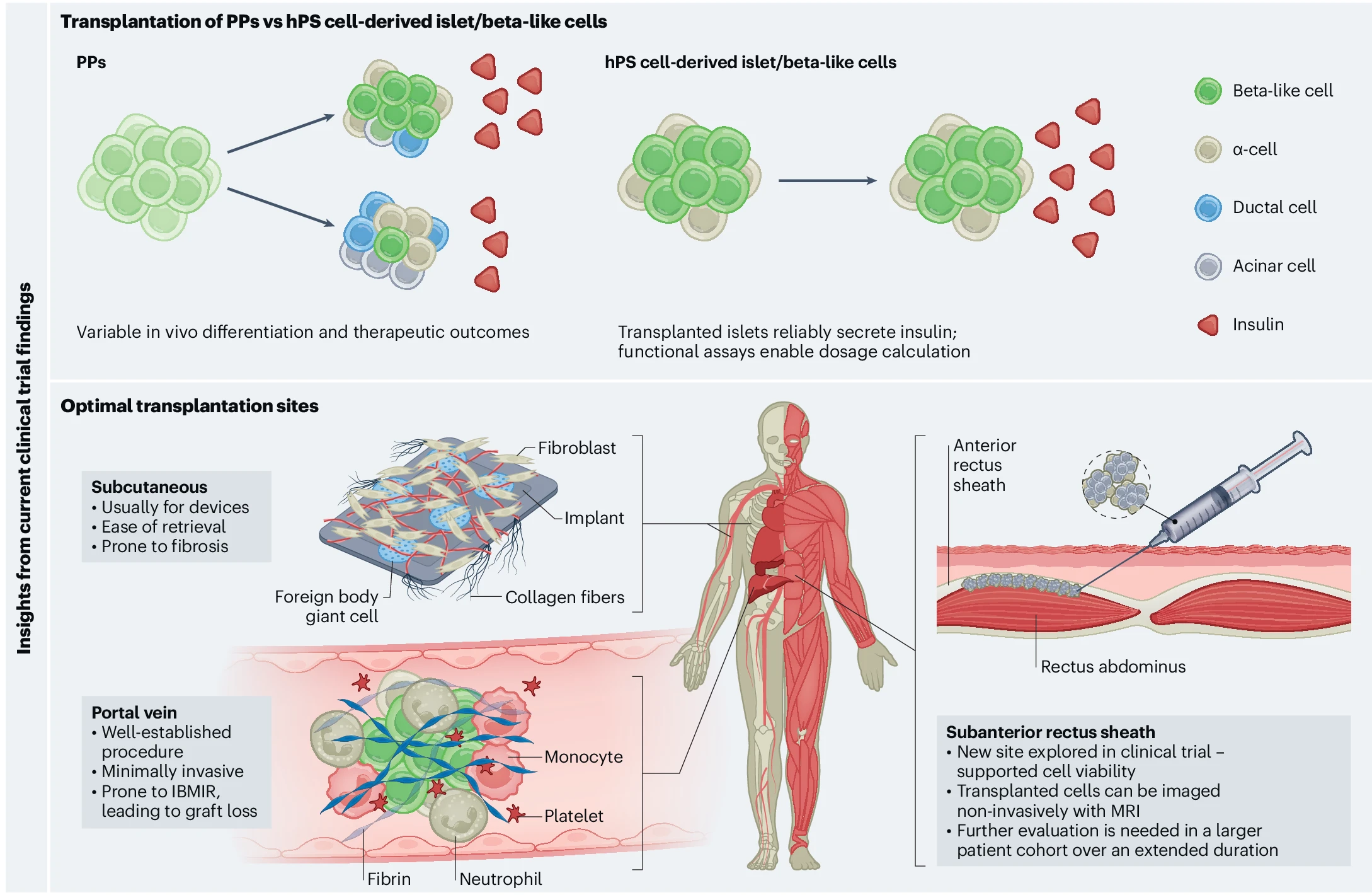 圖2：最新干細胞治療糖尿病的創新和經驗教訓
