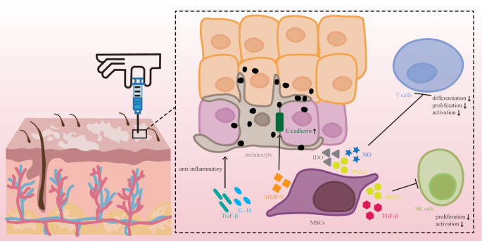 圖1：白癜風患者皮膚注射MSCs后對局部皮膚的潛在免疫調節和抗炎作用