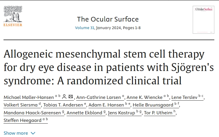 異基因間充質(zhì)干細(xì)胞治療干燥綜合征患者干眼癥：一項(xiàng)隨機(jī)臨床試驗(yàn)