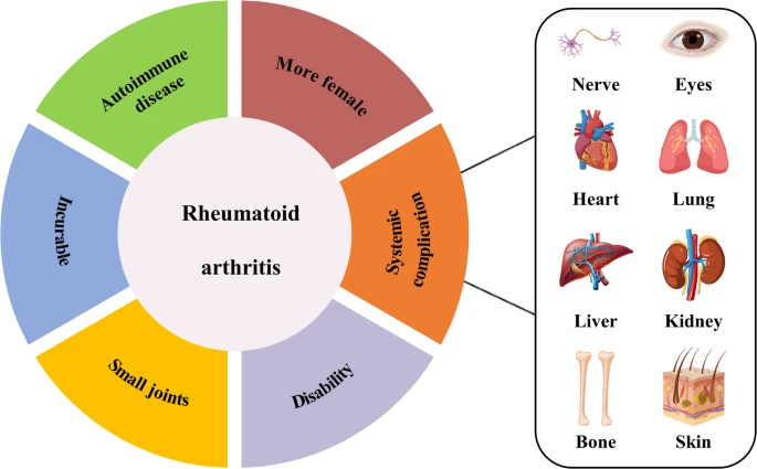 圖1：類風(fēng)濕性關(guān)節(jié)炎的一般特征。