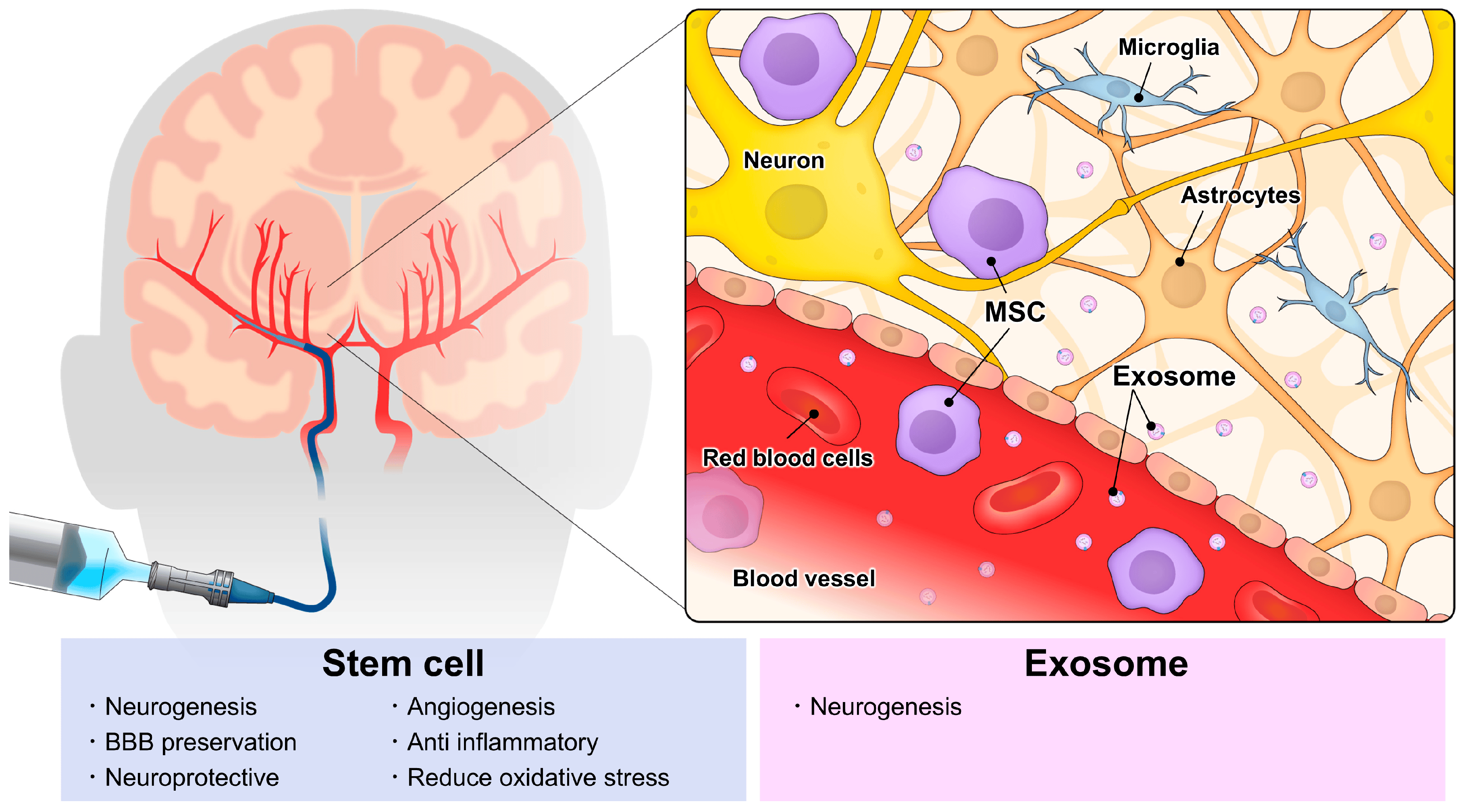 動脈注射干細胞&外泌體治療神經(jīng)系統(tǒng)疾病，打多少細胞好？