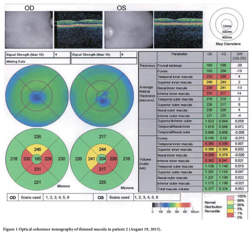 遺傳性視神經病變臨床試驗