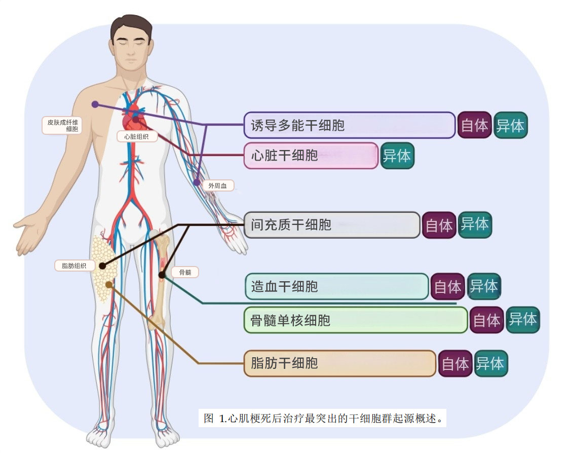 干細胞治療心梗