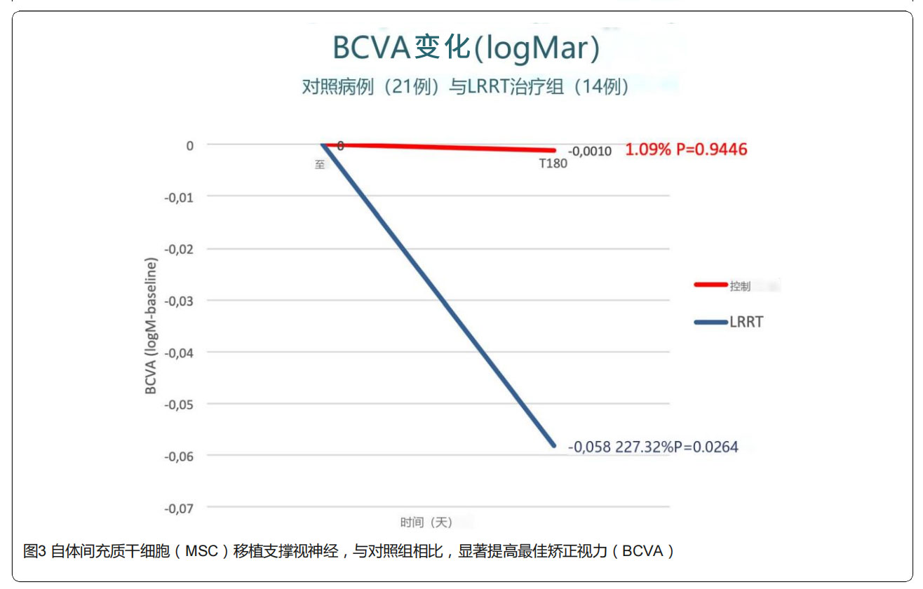 青光眼臨床試驗(yàn)