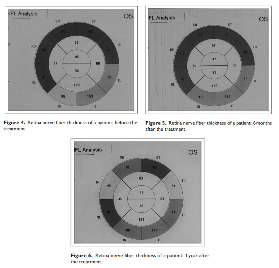 視神經萎縮臨床試驗