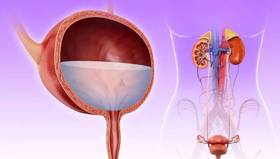 逼尿肌收縮力減退