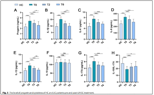 圖5 HC和UC思者在UMSC治療前后的progerin和細(xì)胞因子水平